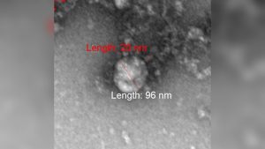 Роспотребнадзор показал первое фото британского штамма коронавируса