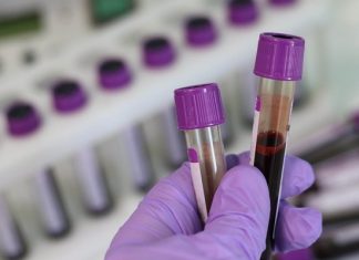 Не мытьем, так… тестами