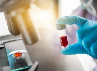 «Вектор»: Высокий уровень антител не гарантирует защиту от COVID-19