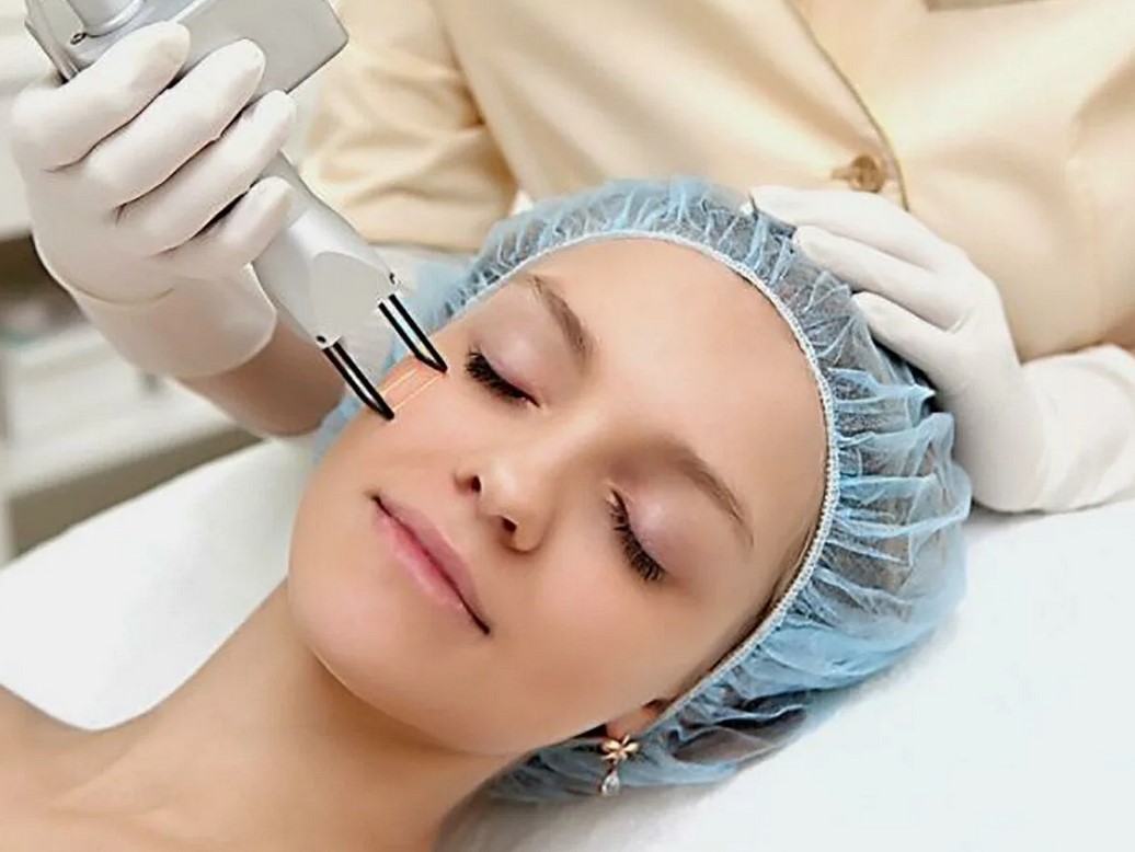 Лазерная шлифовка тёмных кругов под глазами