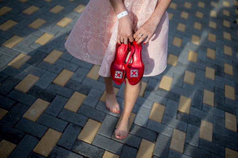 Врач-флеболог назвал простой рецепт для профилактики варикоза