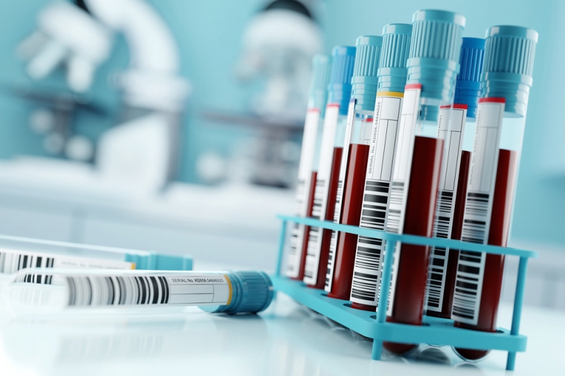 За 2020 год число новых случаев ВИЧ-инфекции снизилось на четверть