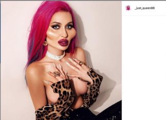 Женщина с самыми большими щеками в мире решила увеличить грудь