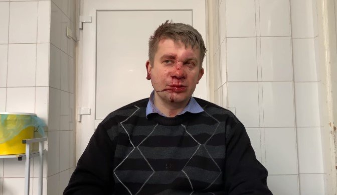 В Запорожье четверо неизвестных избили депутата облсовета