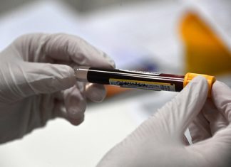 Иммунолог опроверг миф об антителах после прививки от COVID-19