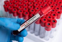 Академик РАН назвал наиболее вероятный источник появления «омикрона»