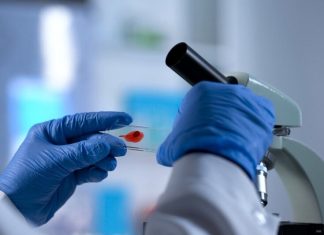 Аргентинка вылечилась от ВИЧ благодаря собственной иммунной системе