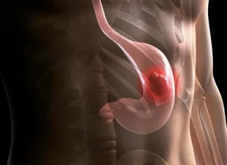 Как избежать рака желудка: практические советы для сохранения здоровья