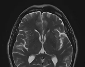 Как проводится МРТ головного мозга: подробное руководство