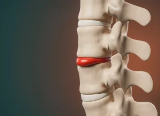 Боль при межпозвоночной грыже: причины, симптомы и методы облегчения