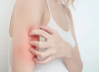 Как лечить псориаз: современные подходы и эффективные методы