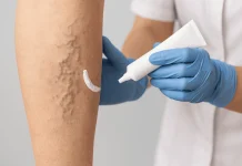 Варикозное расширение вен: причины, профилактика и эффективные решения