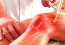 Использование плазмолифтинга при лечении колен: эффективный метод восстановления суставов